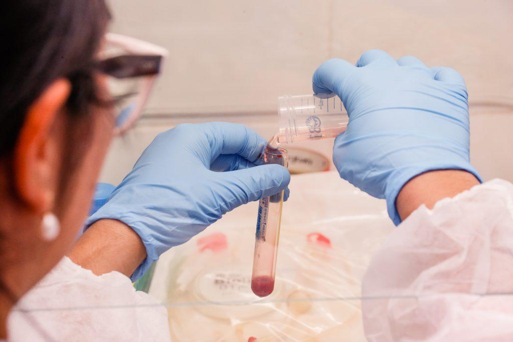 Exame de sangue associado à IA abre caminho para diagnóstico precoce da hanseníase