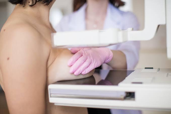 Sem fila para mamografia e preventivo, Vargem Grande do Sul mostra o que a atenção primária do SUS pode fazer pelas mulheres