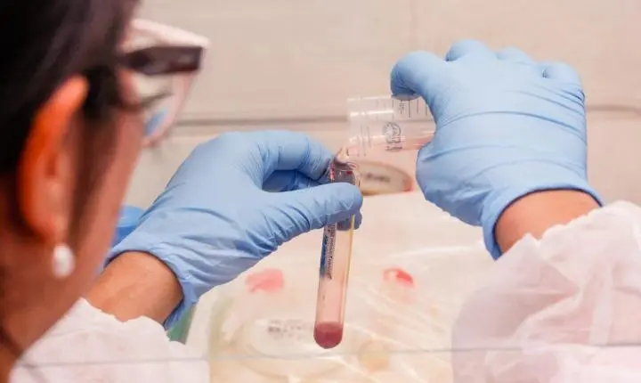 Exame de sangue associado à IA abre caminho para diagnóstico precoce da hanseníase